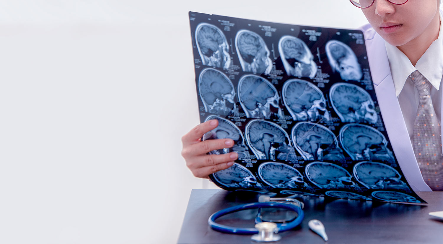 Neurologia