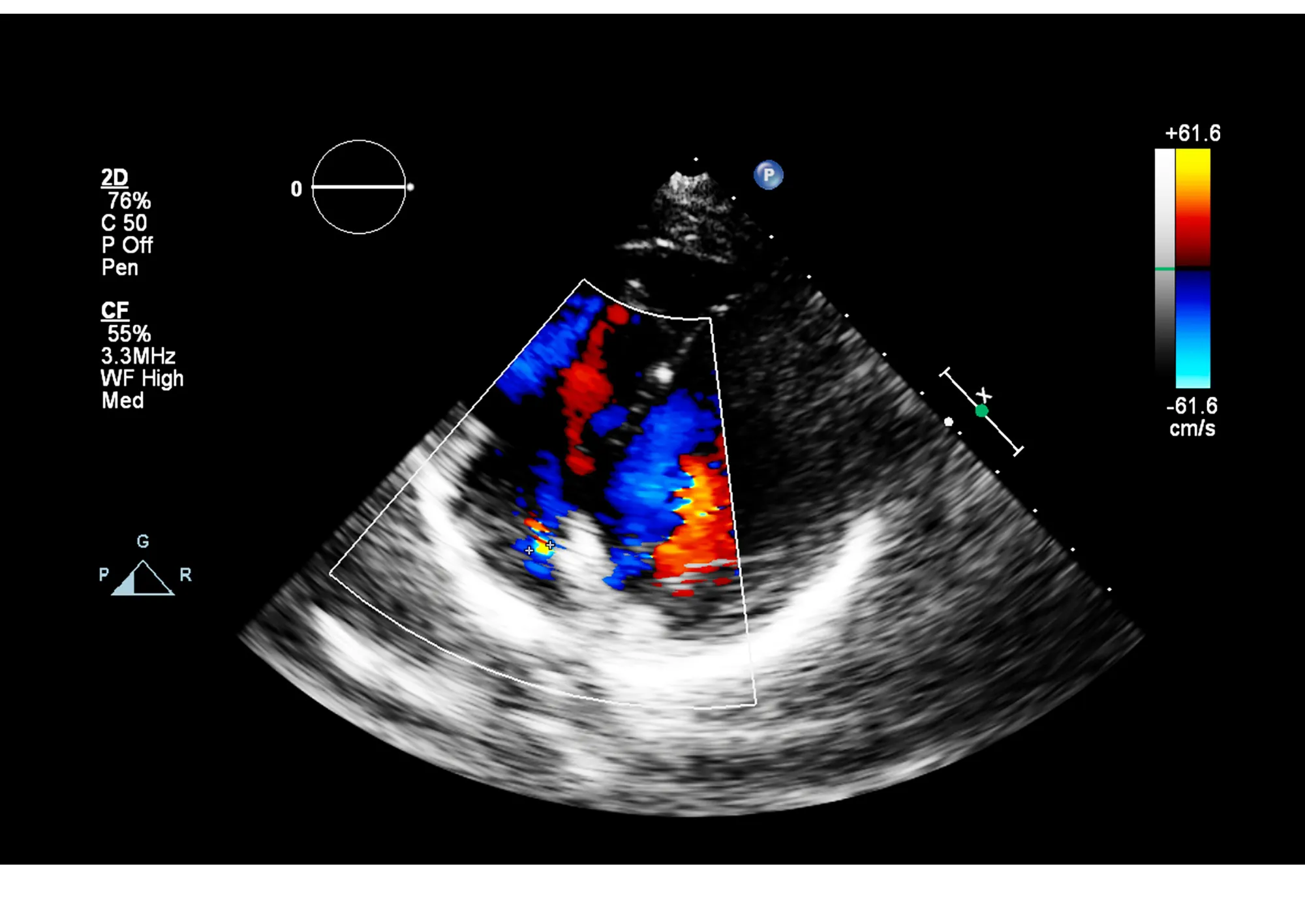 Immagine ecocardiogramma color doppler - Sanismart Medical Center