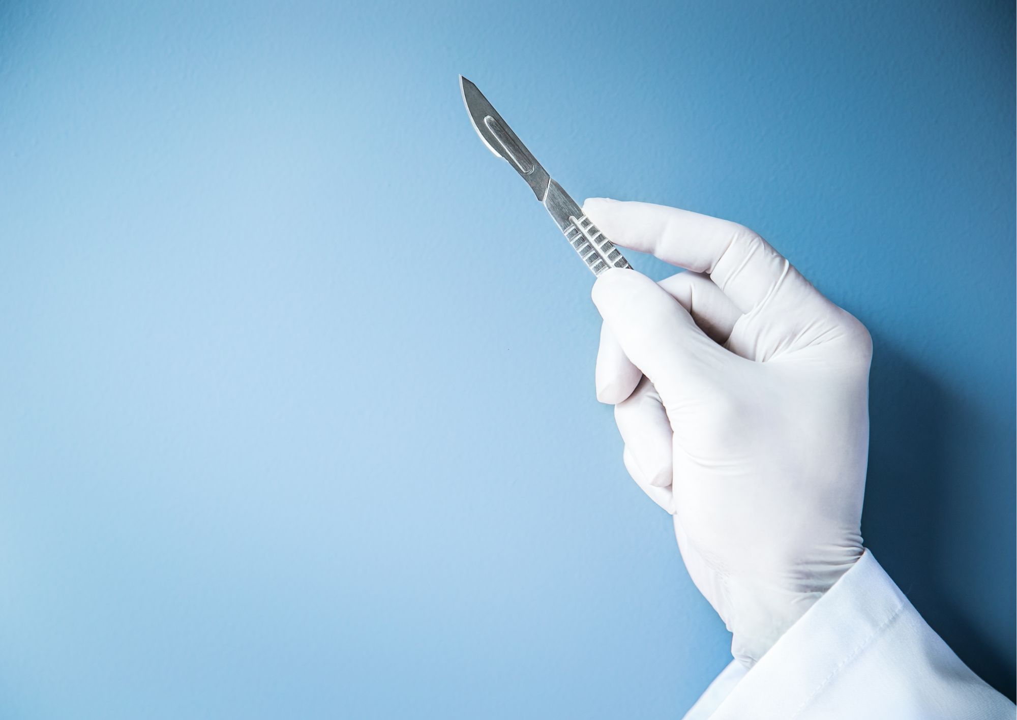 Asportazione di condilomi acuminati: procedura ambulatoriale per rimuovere lesioni da HPV e ridurre fastidi e rischio di diffusione.