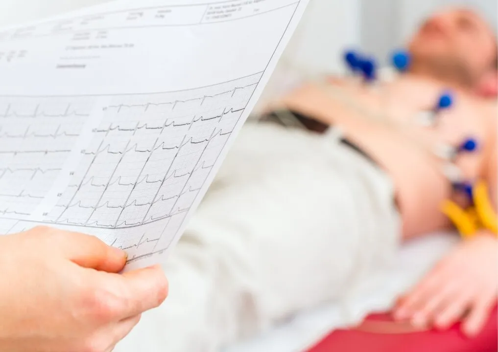 Elettrocardiogramma a Roma al Sanismart Medical Center