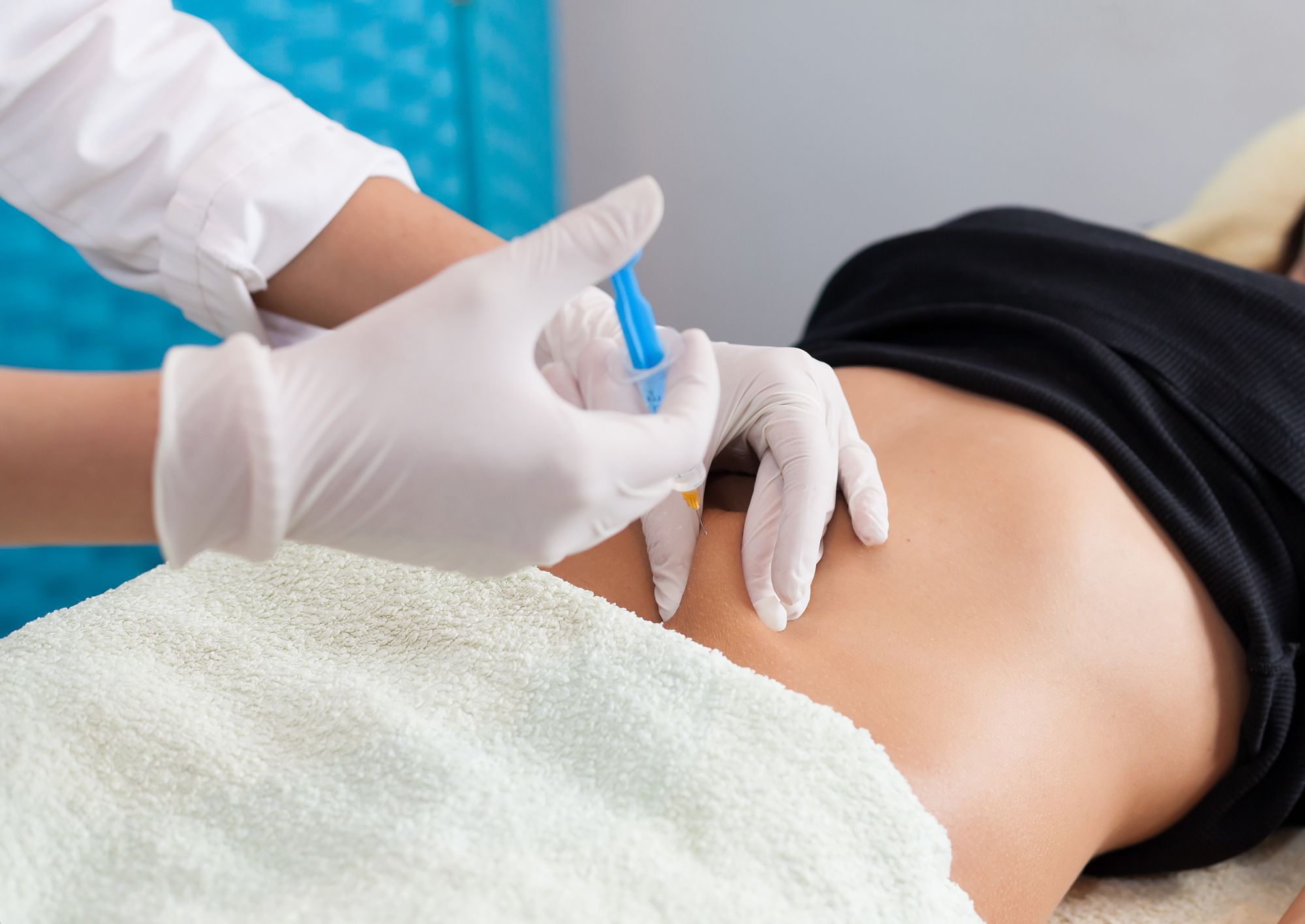 Mesoterapia a Roma