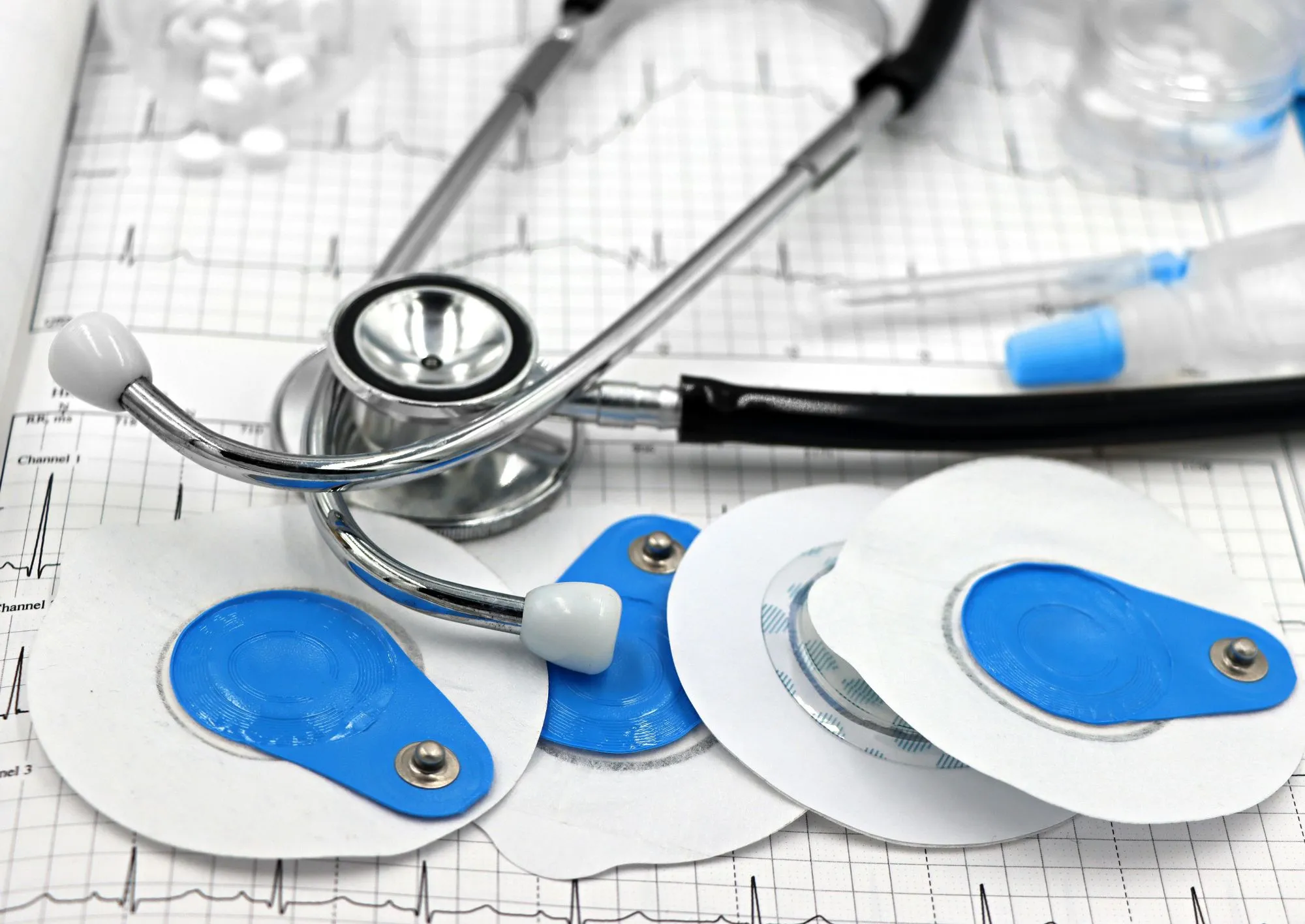 Controllo cardiologico completo a Roma al Sanismart Medical Center