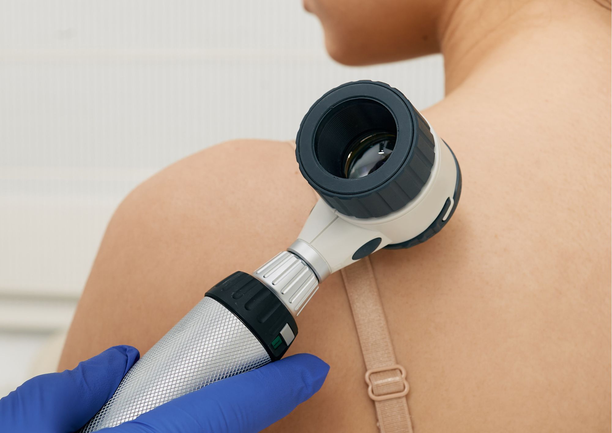 Check up dermatologico a Roma con visita specialistica e mappatura nei digitale. Percorso completo per la prevenzione del melanoma.