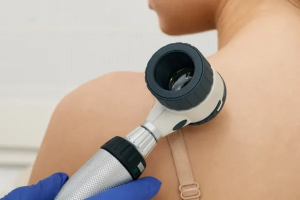 Check-up dermatologico a Roma - Prevenzione dermatologica al Sanismart Medical Center