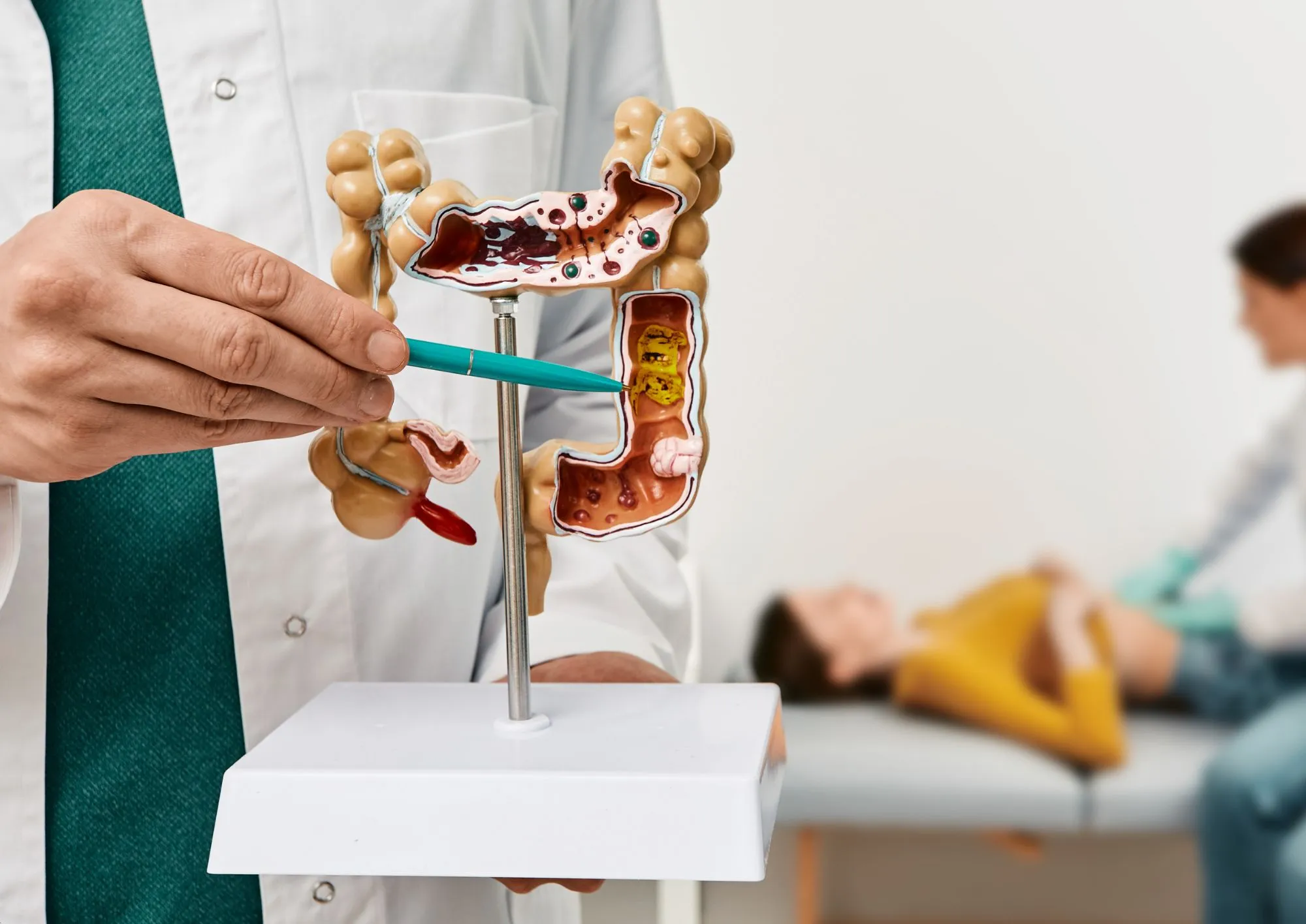 Gastroenterologia a Roma - Sanismart Medical Center