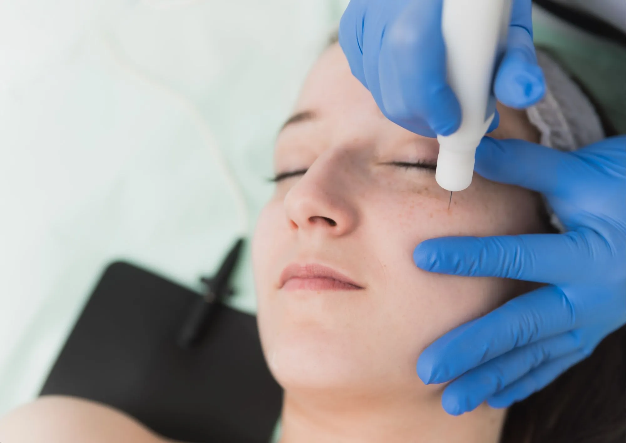 Trattamento plexr a Roma presso Sanismart Medical Center