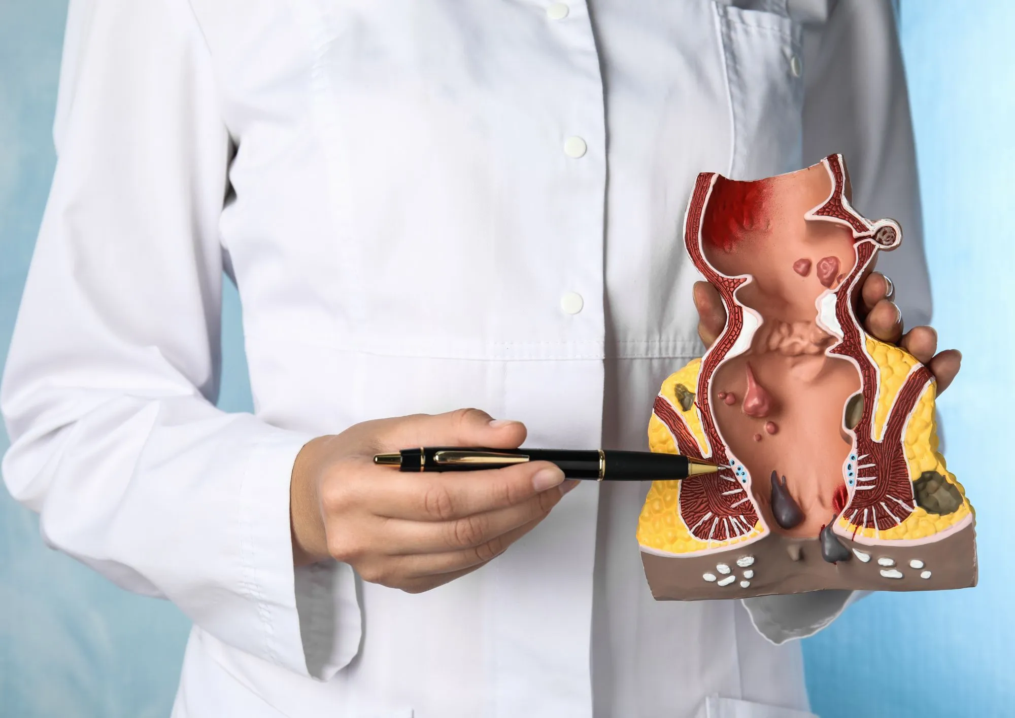 Proctologia a Roma - Sanismart Medical Center