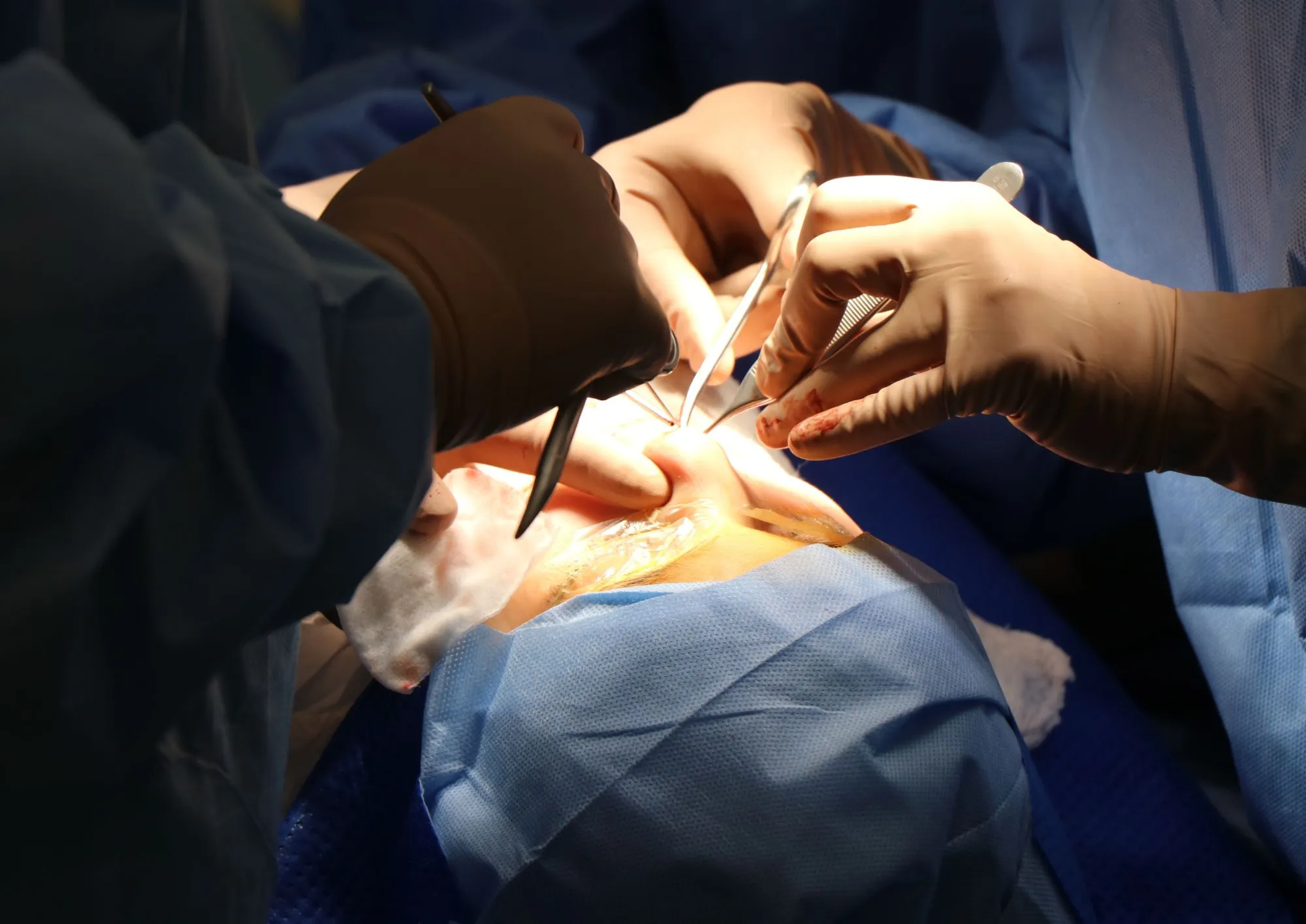 Visita con chirurgo plastico a Roma al Sanismart Medical Center