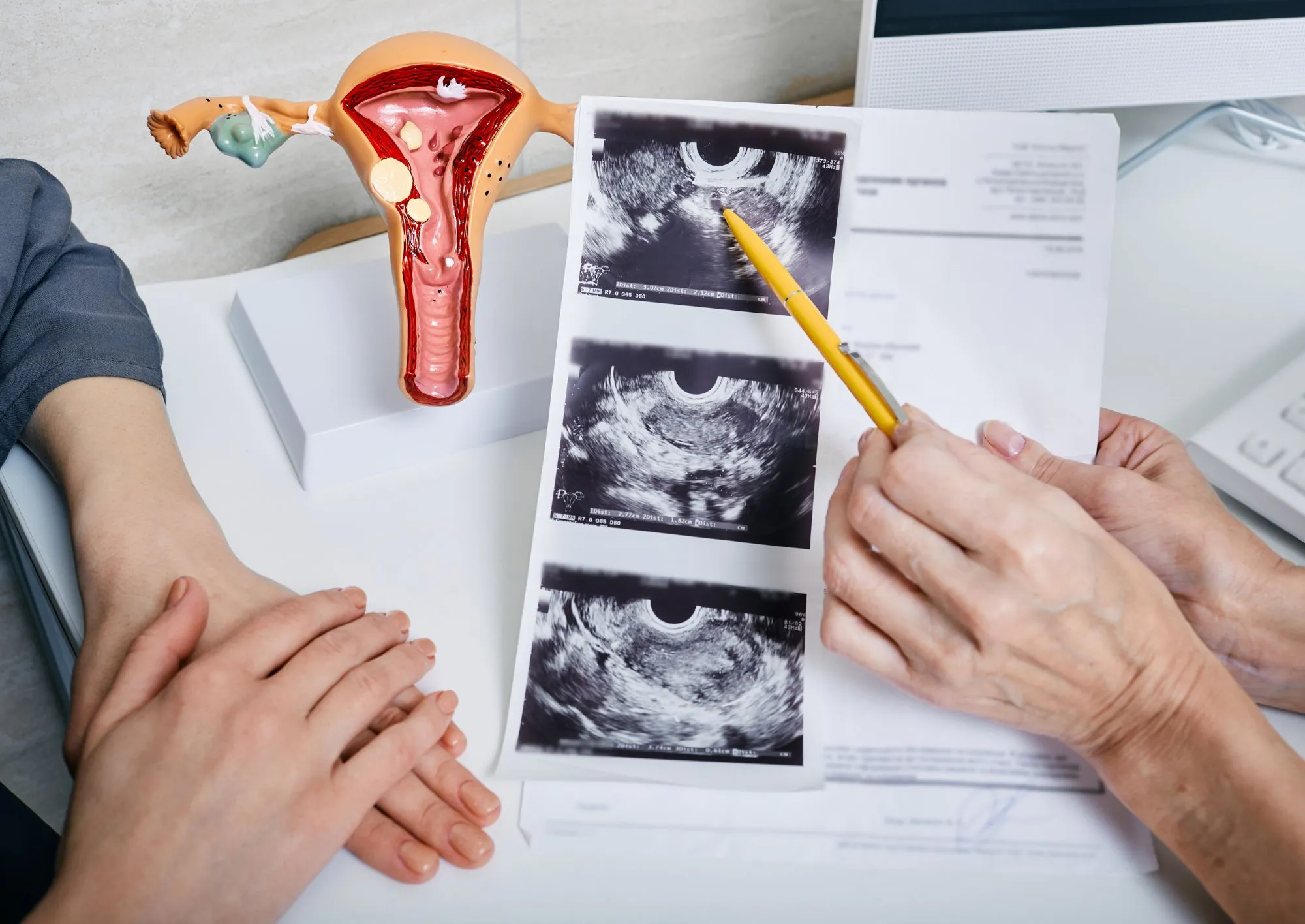 Visita con ginecologa a Roma - Sanismart Medical Center