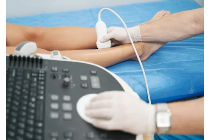 Angiologo a Roma - Angiologia al Sanismart Medical Center