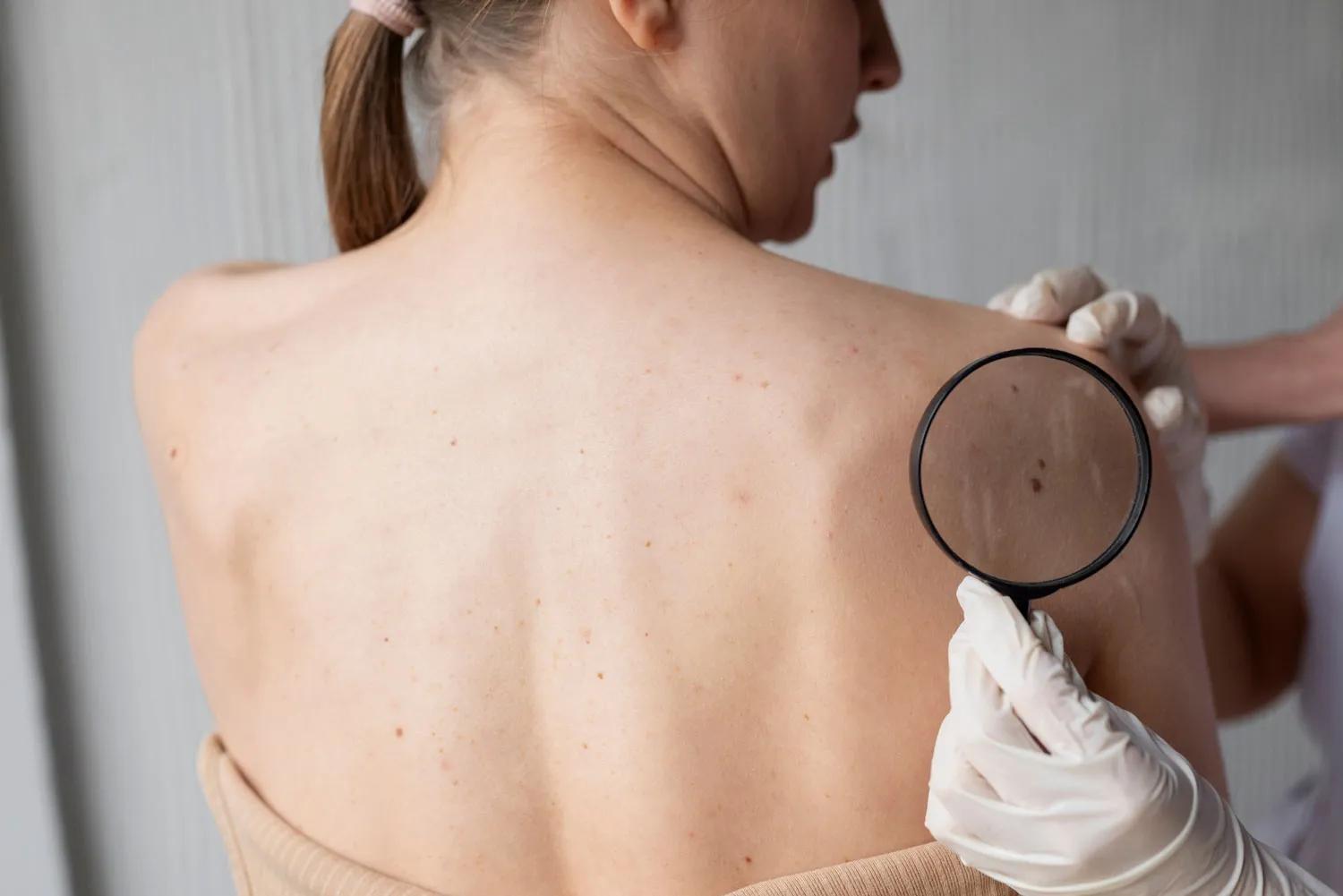 Dermatologo a Roma - Dermatologia al Sanismart Medical Center