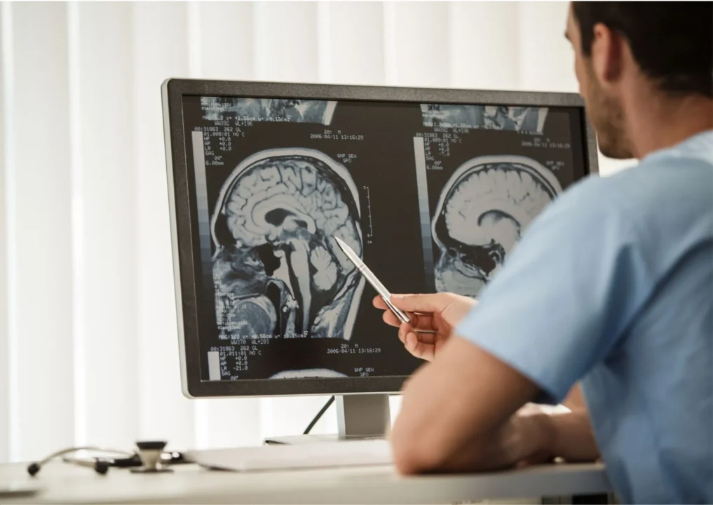 Neurochirurgo a Roma - Neurochirurgia al Sanismart Medical Center