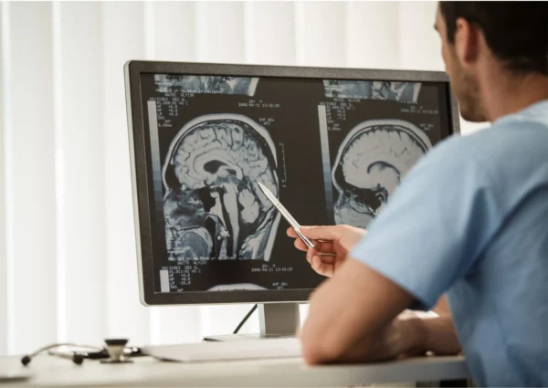 Neurochirurgo a Roma - Neurochirurgia al Sanismart Medical Center